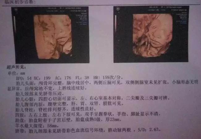 2、免費測試自己生兒子還是女兒:生女兒好還是生兒子好？