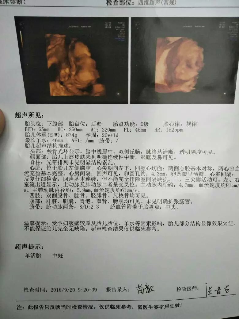 4、四維看男孩女孩訣竅:四維辨別男女
