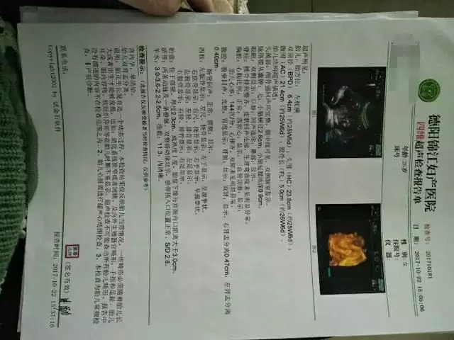 前三個月懷男孩有什麼特徵最准：懷男孩有什麼反應