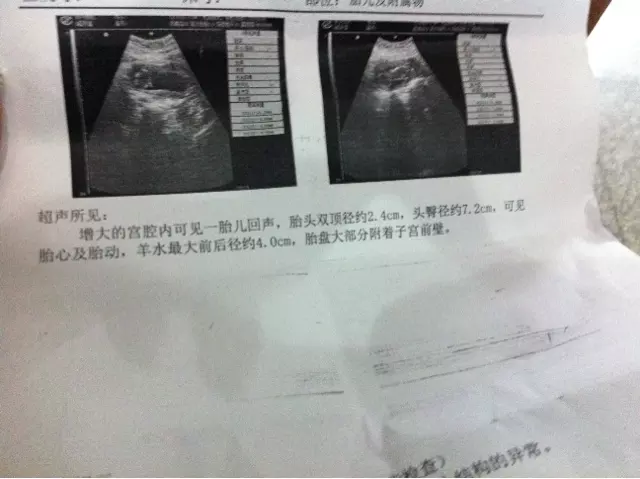 懷孕7個月，雙頂徑8.0，股骨長5.4，右後壁，是男孩女孩