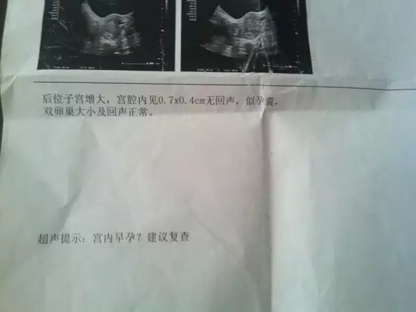 懷孕一個月怎麼打掉最安全：懷孕一個月了如果打掉的話需要多少錢
