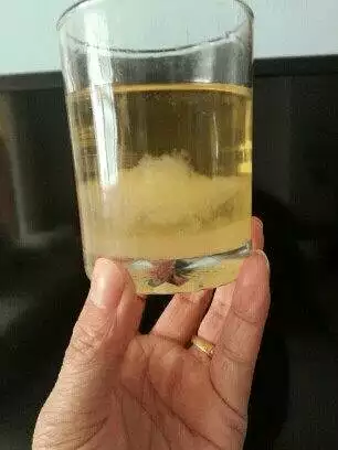 酒精能測出男孩女孩嗎：酒精能測出來懷男孩還是女孩