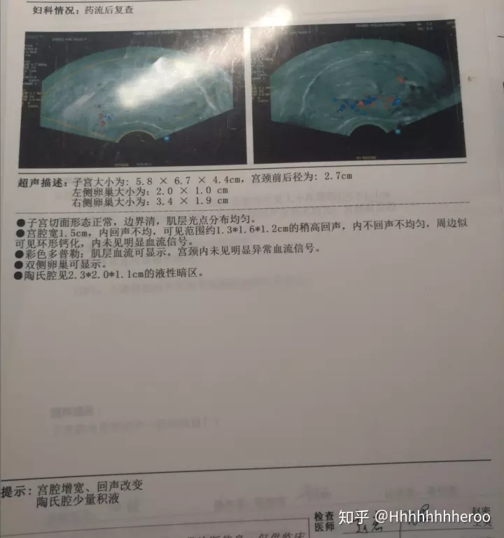懷女兒最準的癥狀播種網：懷女孩的特徵最準的是什麼啊？如何可以懷女兒？