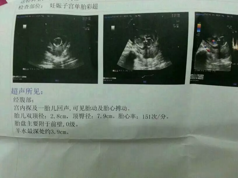 測試懷孕是男是女最準確方法：怎樣算生男生女100%準確