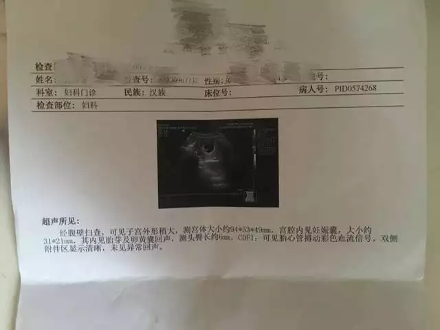 月經遲遲不來可能是懷孕，但有8個癥狀，恭喜你可能了，你知道嗎？