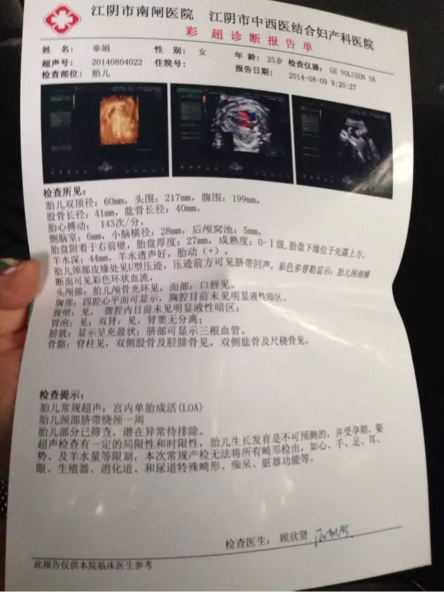 1、女虛歲27與男虛歲26婚配:女虛歲24歲和男26虛歲婚配好欠好？