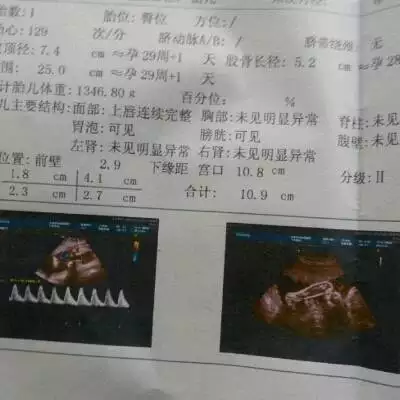 快速知道懷男孩女孩表：怎樣知道懷男孩子還是女孩子