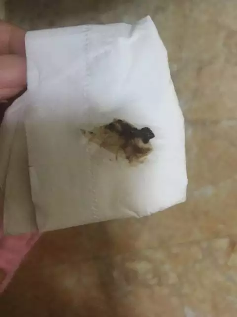 孕期物看男孩女孩：懷孕初期有褐色物是生男孩還是女孩