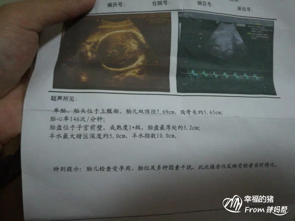 頭胎頭旋看下胎男女准嗎：頭上的漩渦可以看出下一胎生男生女嗎