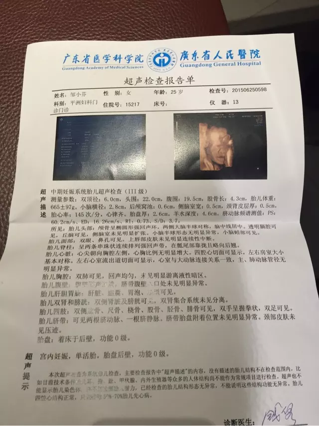 懷孕90天能查出男孩女孩嗎：90天能看出男女嗎