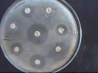 沙門氏菌在哪種食品中最常見：專家進，請問食品檢驗中，如何判斷沙門氏菌的來源？