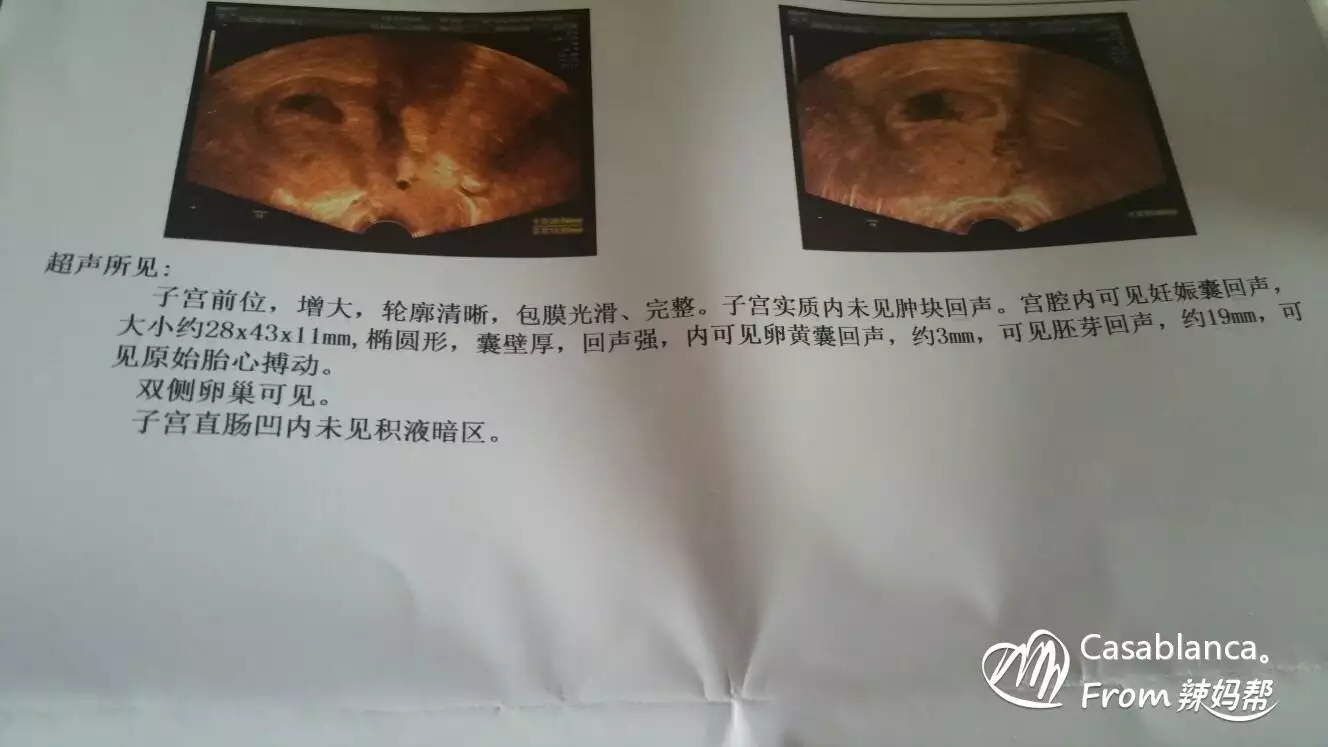 早期懷男孩的癥狀最準的：早期懷男孩有哪些特徵 - 