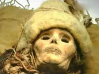 我家烏龜四腳幹了，頭也說進去了，眼睛也凹陷了，但有時還能動，它還活着嗎？