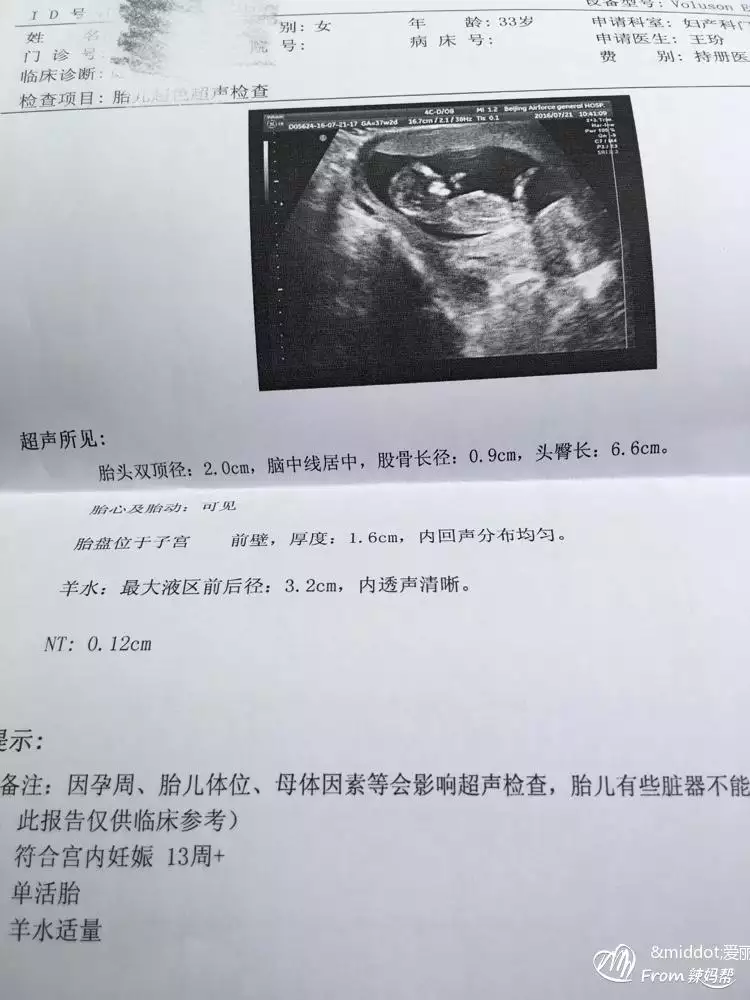 6、怎麼測算男女:生孩子怎麼算男女