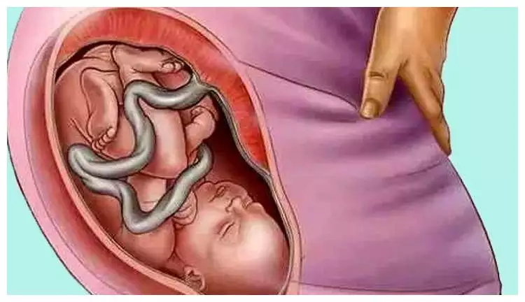 孕期可以嗎需要注意什麼：懷孕初期因為了，應該注意些什麼