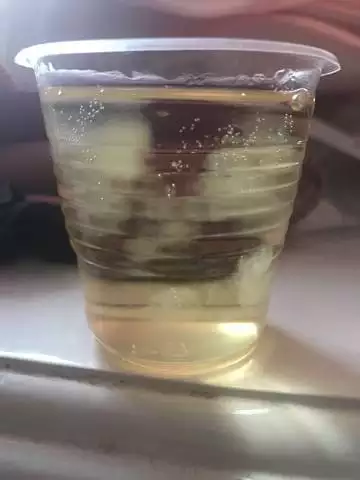 孕婦早上晨尿是清的是男孩嗎：懷男孩的特徵都有哪些？