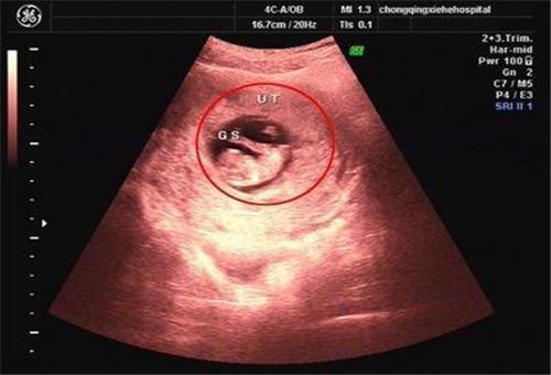 5、生兒子最準的方法:生兒子經驗哪些比較準的？