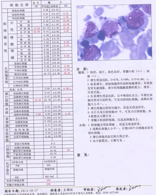 各屬相生幾月是骨隨婆：水腫嚴重嗎，如何治療