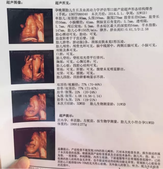 孕媽屬相看男女男孩女孩：男人的心裏媽重要還是媳婦重要？