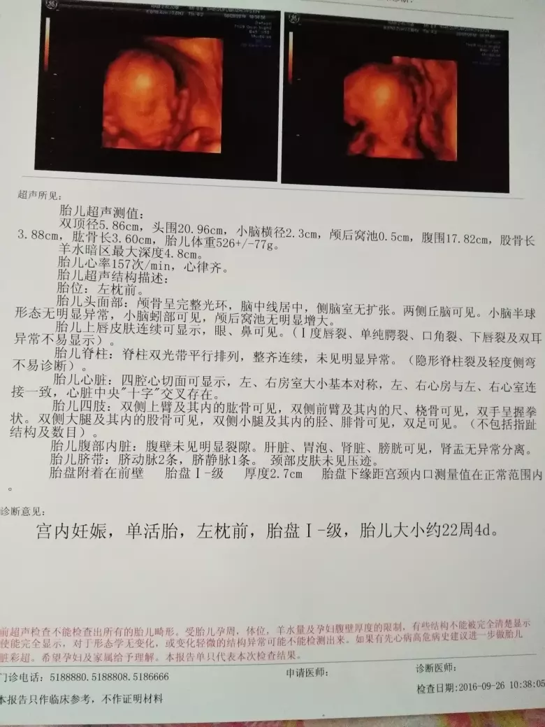 四維彩超暗示女寶：四維彩超男孩女孩