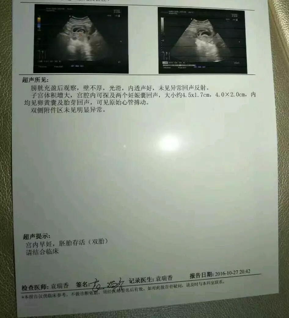 4、輸入懷孕月份算男女:大家相信生男生女是命中註定的事嗎