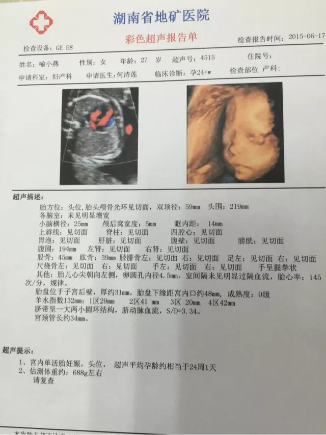 怎麼知道自己有沒有男孩命：算卦的說我命里沒有兒子可信嗎？