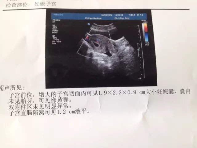 懷孕怎麼分辨男女有幾種方法：懷孕想知道男女有幾種方法？
