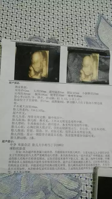 懷兒子有哪些明顯癥狀：懷男孩初期癥狀有哪些？