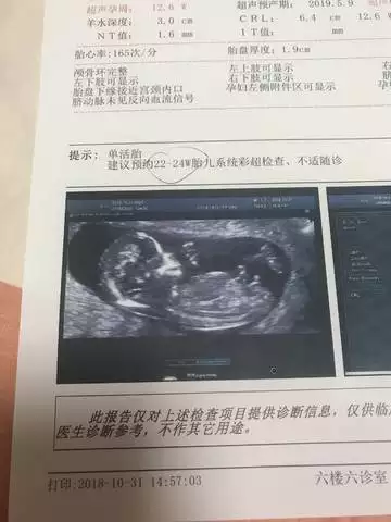 nt單可看男女準確率90：怎麼通過nt看男女性別