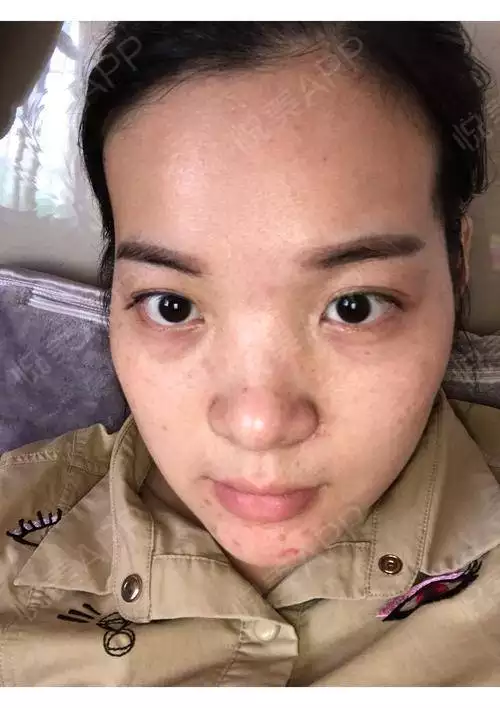 1、眉骨高，顴骨高，太陽穴凹陷的女人是不是克夫呀？這種女人的運勢怎麼樣？