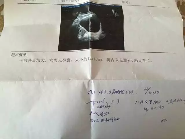 孕早期根據孕囊推算孕周準確嗎：孕囊大小推算孕周