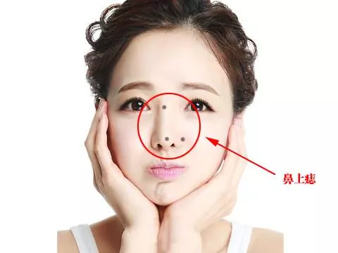 1、能幹大事業的女人痣:女性的痣有哪十處是富貴痣？