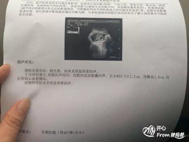 1、6一7周孕囊大小看男女:如何利用b超單判斷男女