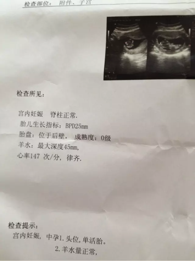 2、輸入懷孕月份算男女:生男生女順口溜