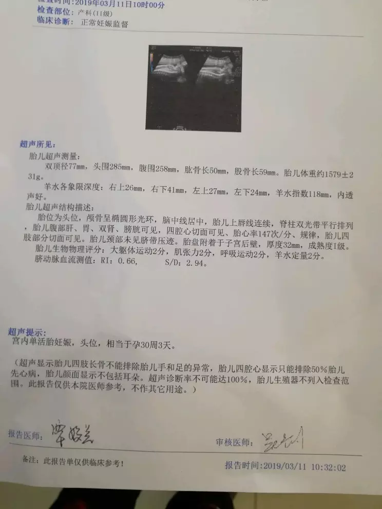懷孕做b超准還是算卦准：懷孕了想知道男女算命能準確嗎？