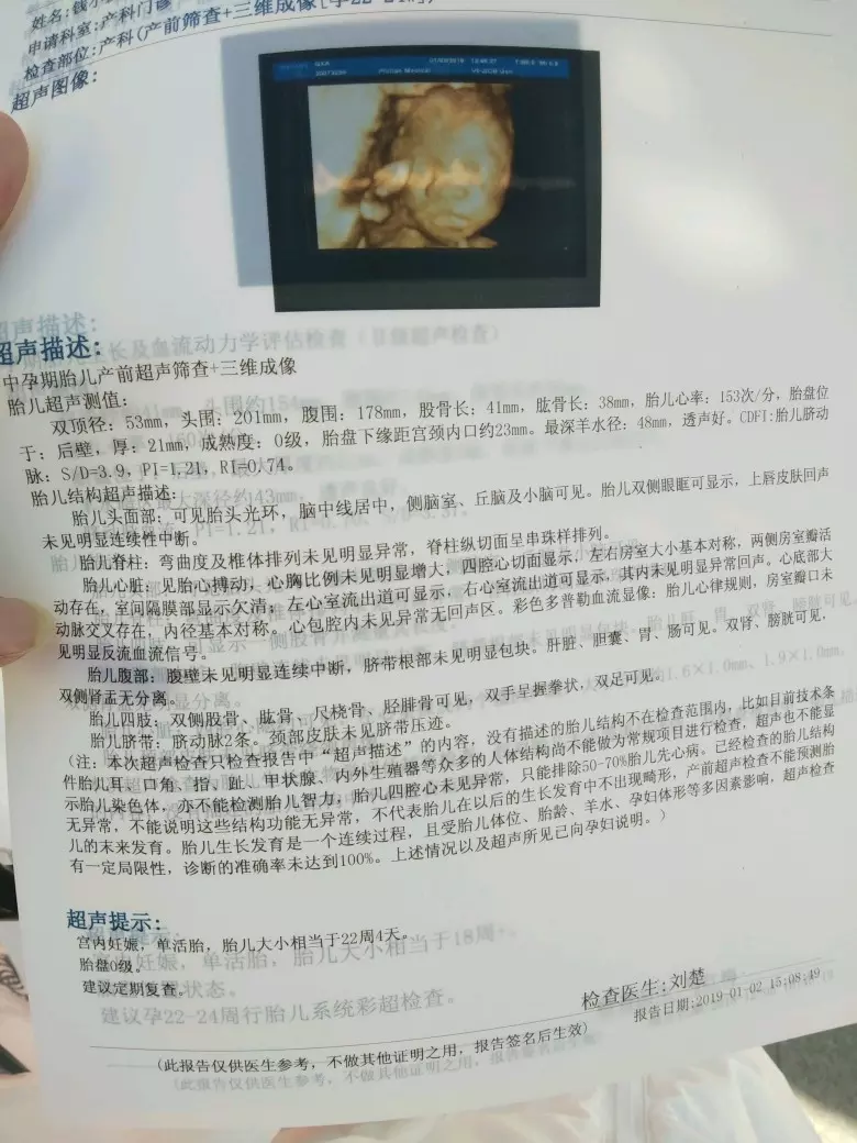2、B超四維一看就是男孩:教你從B超單子看寶寶性別,男娃女娃一眼就猜准!