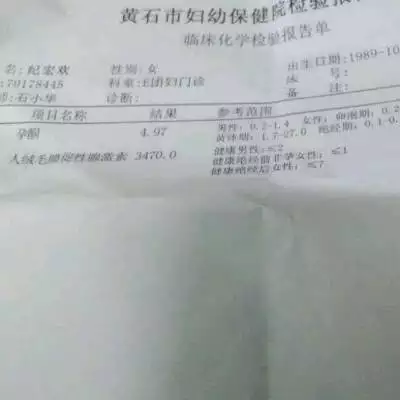 5、懷孕45天抽血查准嗎:母血鑒定有y就一定是男孩嗎