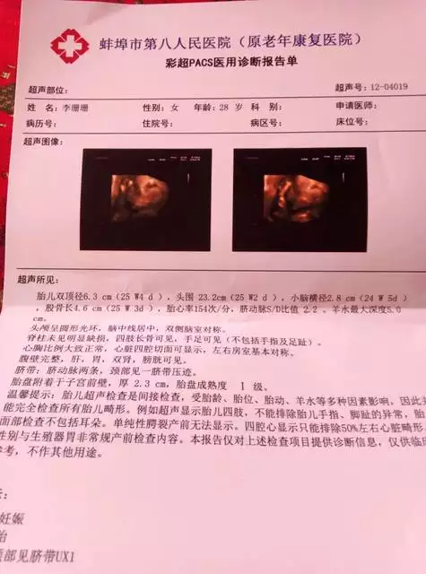 怎樣辨別男孩女孩最准：有什麼最準確的方以辨別男女