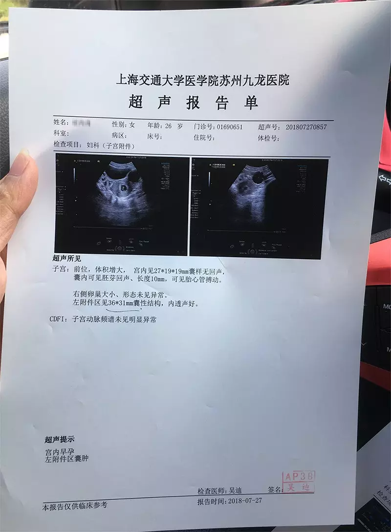 天檢查男孩準確不：天做思維看性別的準確率是多少