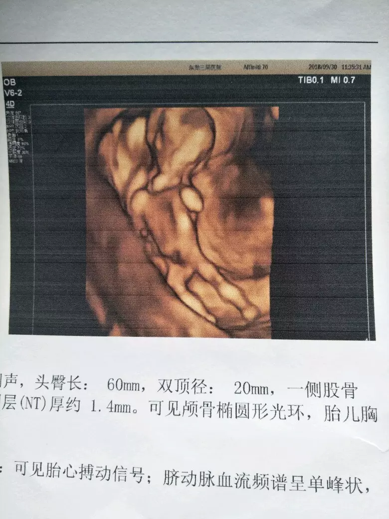 自己怎麼判斷男孩女孩最准方法：有什麼最準確的方以辨別男女