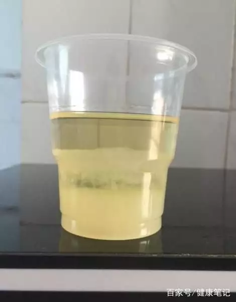 孕婦的晨尿是什麼顏色：晨尿這個顏色正常嗎？