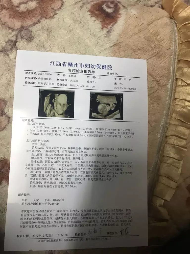 已生男孩的四維彩超圖：誰會看這個四維彩超圖，可以看出是男孩還是女孩