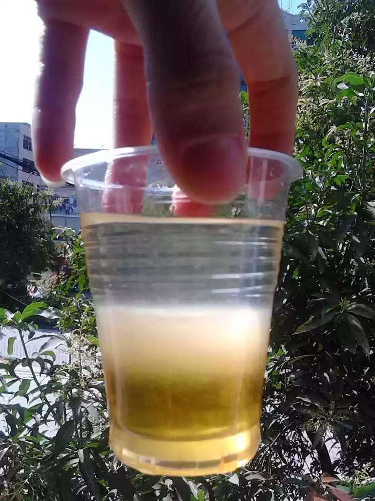 1、打了一針。我，男孩，13歲。我晚上時，是又紅又黃的！我這還是次撒這種尿，我以為是打...