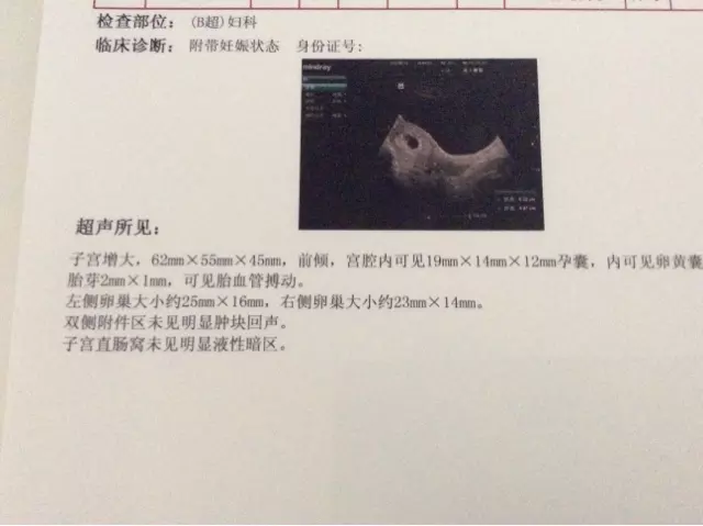 怎麼算懷還是女寶：算懷男孩女孩的計算公式是什麼