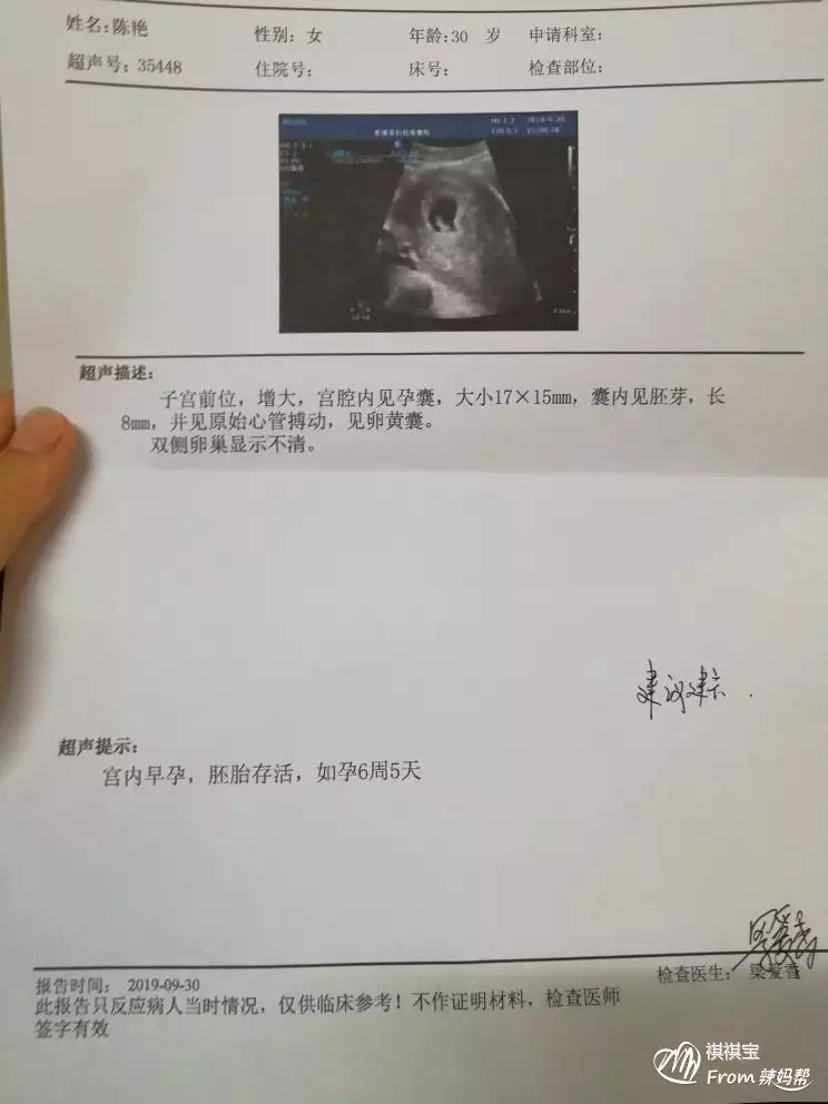 末次月經看生男生女准嗎：最准懷女孩徵兆