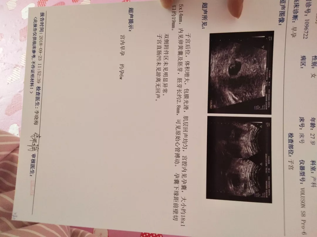2、懷孕什麼感覺是生女兒:你們懷孕的時候會感覺出來自己懷的是男生還是女生嗎？