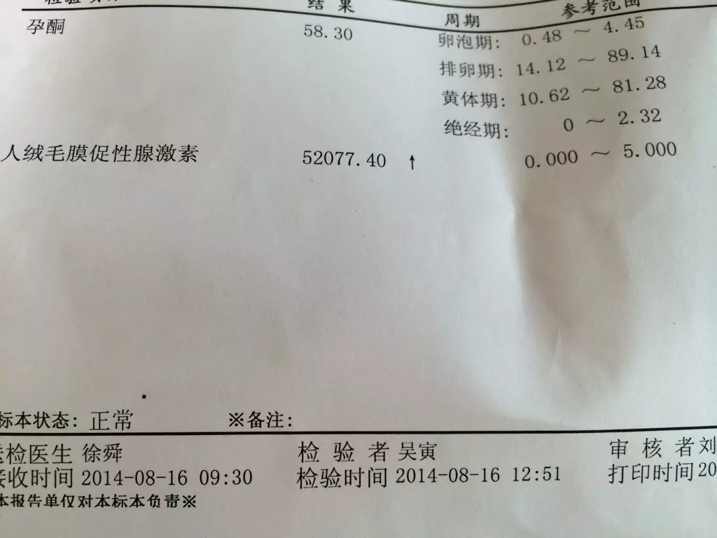 1、50天驗血女孩55天驗血男孩:你好，做血液檢查怎麼可以知道男孩女孩？