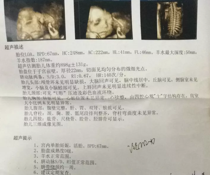 懷孕12周b超像男孩不知道這個準不準的，大家告訴我下吧，非常感謝。