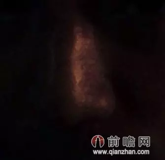 生男生女b超單上有暗示：從B超單怎樣才能看出是男孩還是女孩？