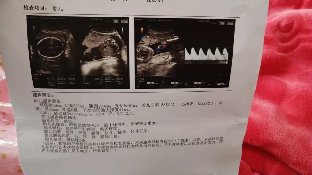 4、孕期日曆表男孩女孩:虎年生男生女表